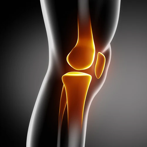 Chiropractic Laguna Hills CA Chronic Bone Knee Pain